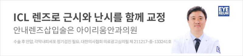 ICL렌즈삽입술 궁금증, 쉽게 알아보기