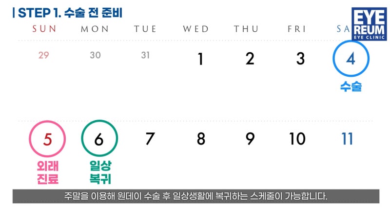 스마일라식 병원 원데이라식 Step 6