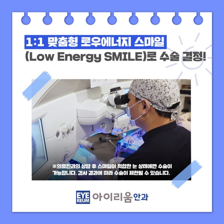 스마일라식 렌즈 오래끼면 못 하나요?