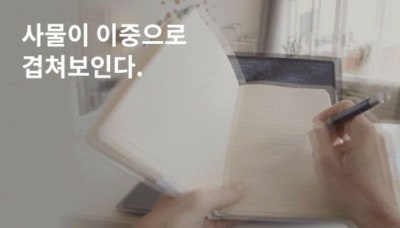 백내장수술가격 알아보고 있다면, 좋은 수술결과를 위한 안과 조언 사진 2