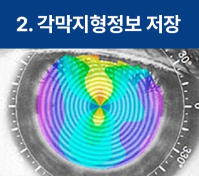 강남역라식 라섹 잘하는 안과 어디로? 사진 5