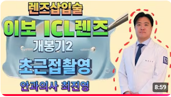 이보ICL 렌즈 실사 - 아이리움 최진영원장 언박싱