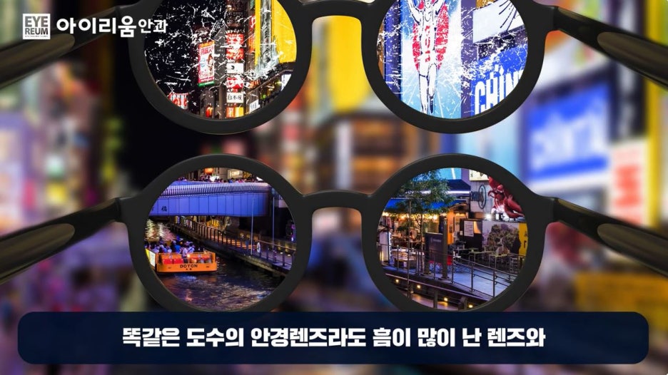 스마일라식의 진화, 빛번짐 해결을 위한 수술법 사진 11