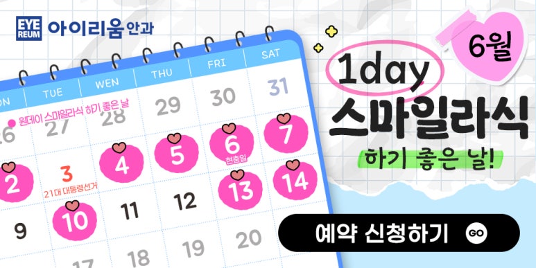 스마일라식라섹 검사 비용이 무료?(★기간한정) 사진 7