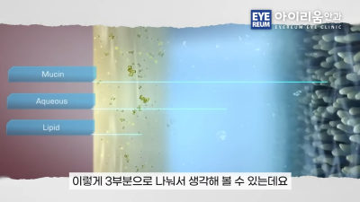 눈 건강 관리|루테인·온열안대·눈 세정제, 제대로 알고 사용하세요 사진 13