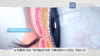 눈 건강 관리|루테인·온열안대·눈 세정제, 제대로 알고 사용하세요 사진 12