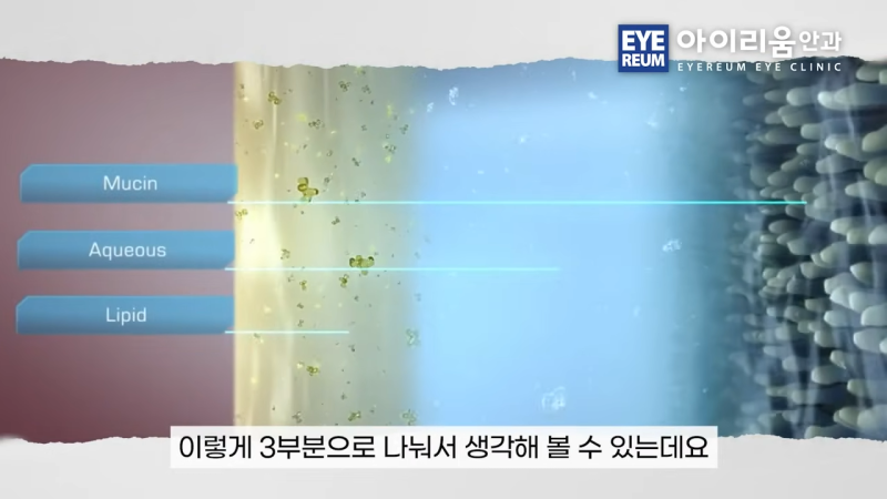 안구건조증 치료, 에어컨 바람 때문에 눈이 더 건조하다면?