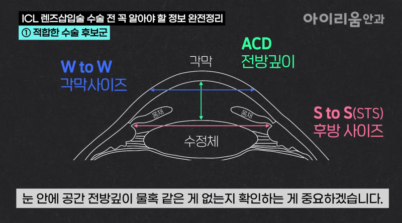 [ICL 잘하는 안과 고르는 법 1] ICL 렌즈삽입술, 검사가 중요한 이유 사진 5