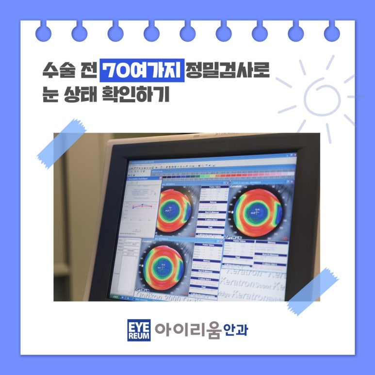 스마일라식, 스마일프로, 스마트노바 차이점은? 레이저 장비부터 수술법, 가격까지 비교 사진 10