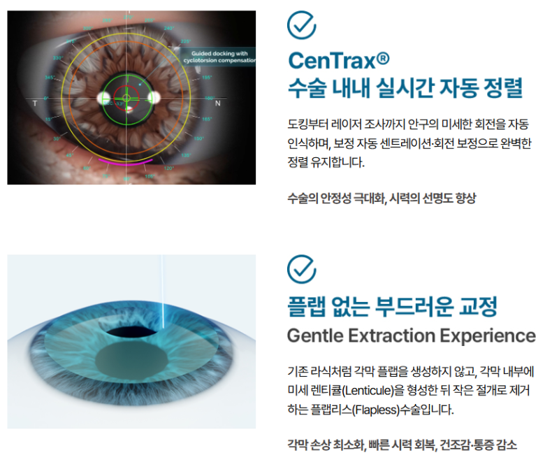 스마일라식, 스마일프로, 스마트노바 차이점은? 레이저 장비부터 수술법, 가격까지 비교 사진 6