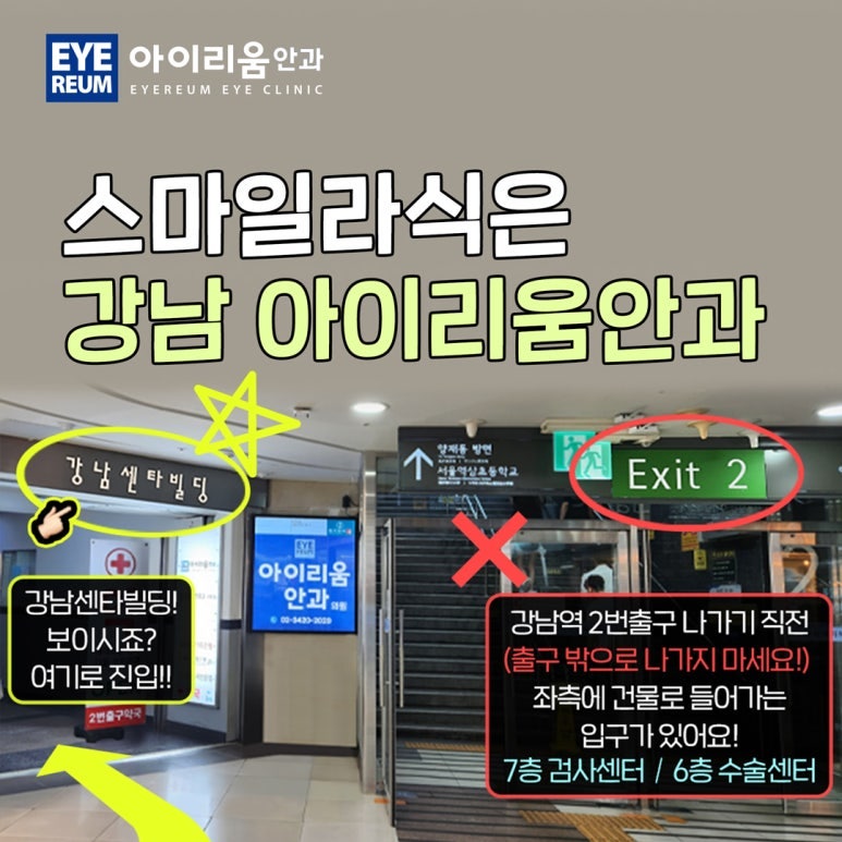스마일라식, 스마일프로, 스마트노바 차이점은? 레이저 장비부터 수술법, 가격까지 비교 사진 14