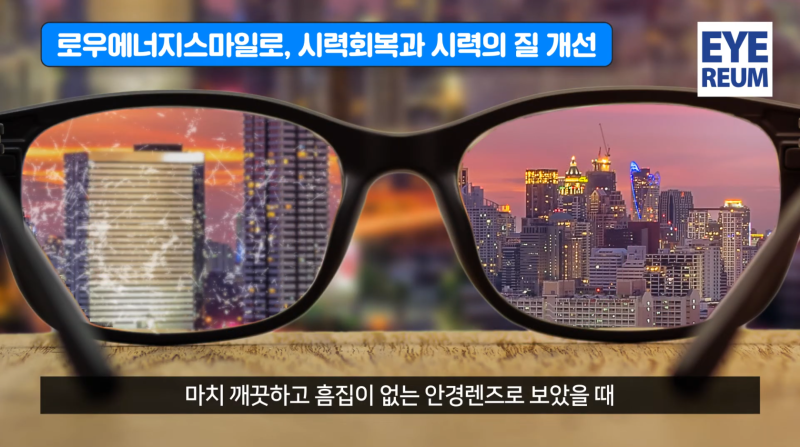 스마일라식, 같은 1.0 시력인데 만족도는 왜 다를까? 고위수차와 '시력의 질'이 중요한 이유 사진 6
