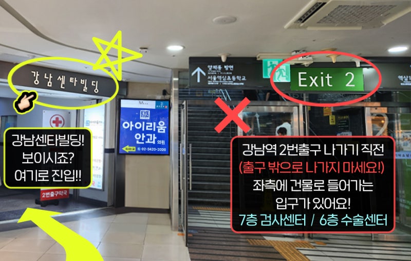 강남라식 검색중이세요? 대학생스마일라식 전 꼭 확인하세요! 사진 2
