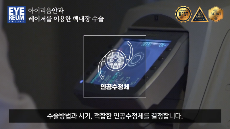 40대 스마일라식, 노안교정까지 가능할까요? -강성용원장 싱가포르 국제학회(SNEC) 발표 핵심정리 사진 8