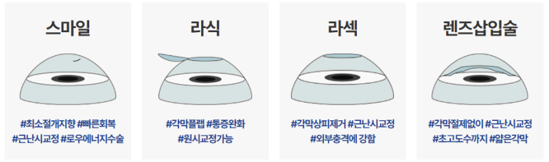 강남안과 어디로 갈까? 스마일라식·렌즈삽입술 알아보기 전 check 사진 5