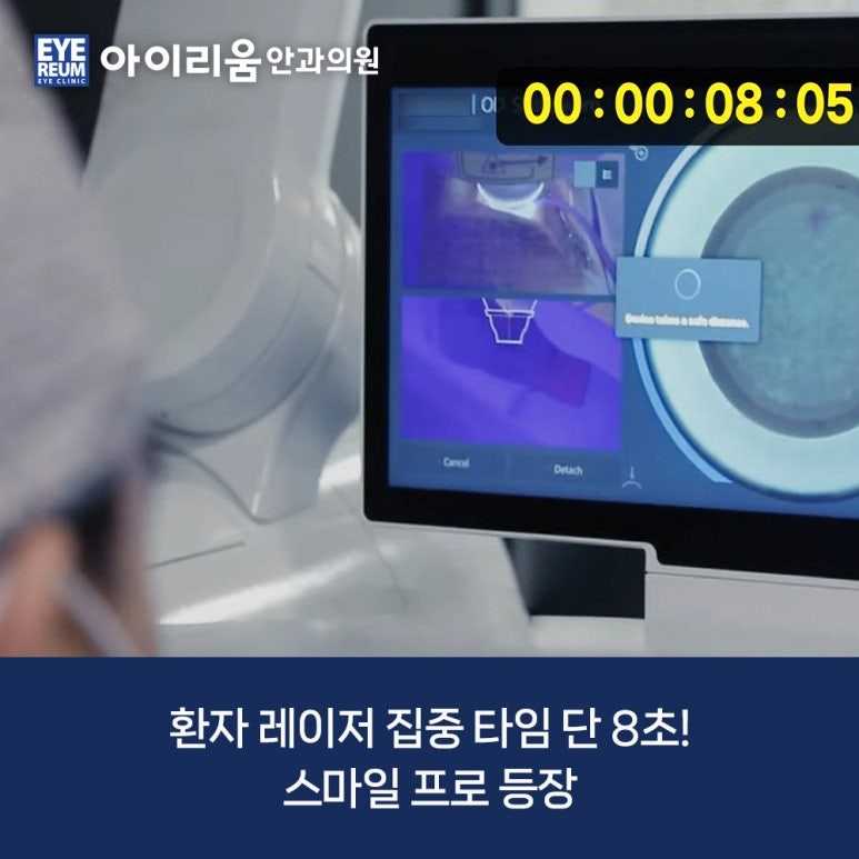 스마일라식 회복기간, 다음 날 어디까지 가능할까 & 뉴스마일라식 확인하기(스마일프로·스마트노바) 사진 6