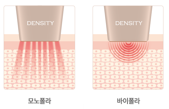덴서티 알파팁, 클래식·하이팁과의 차이점 3가지 - 알파 엠버서더가 설명드립니다! 사진 6