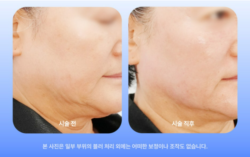 힐로웨이브 쥬베룩 비교, 결과가 2% 아쉬운 2가지 이유