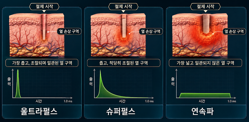 여드름 흉터 프락셀, 몇 번에 얼마나 좋아질까? 유형별 치료 단계 총정리 사진 6