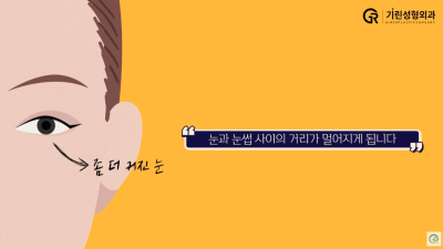 [기린성형외과] 어제보다 오늘 더 젊어지는 기린 이마거상_이마거상 Q&A