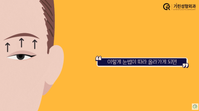 [기린성형외과] 어제보다 오늘 더 젊어지는 기린 이마거상_이마거상 Q&A 사진 3
