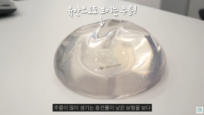[기린성형외과의원] 자연스럽고 만족스러운 결과_마른체형의 가슴성형 수술일지 사진 6