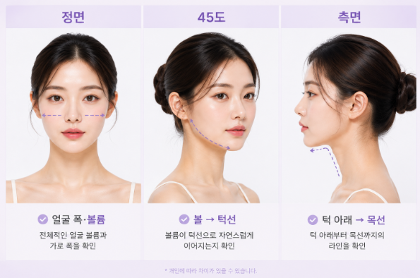 갸름주사 몇 번 받아야 할까요? 횟수와 주기 알아보기 사진 5