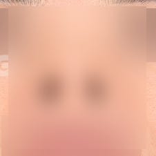 코재수술비용 병원별 차이 비교분석 사진 2