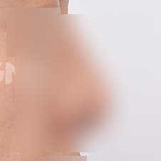 한쪽코막힘 원인과 해결법 3가지 사진 4