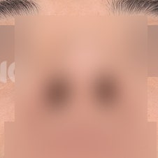 한쪽코막힘 원인과 해결법 3가지 사진 3