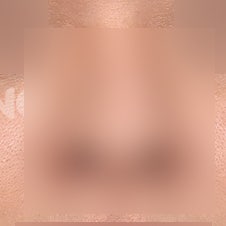한쪽코막힘 원인과 해결법 3가지 사진 2