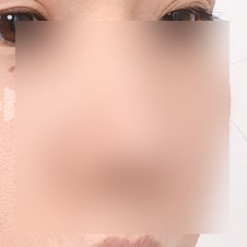 코끝성형 비용, 합리적인 가격대는 얼마? 사진 2