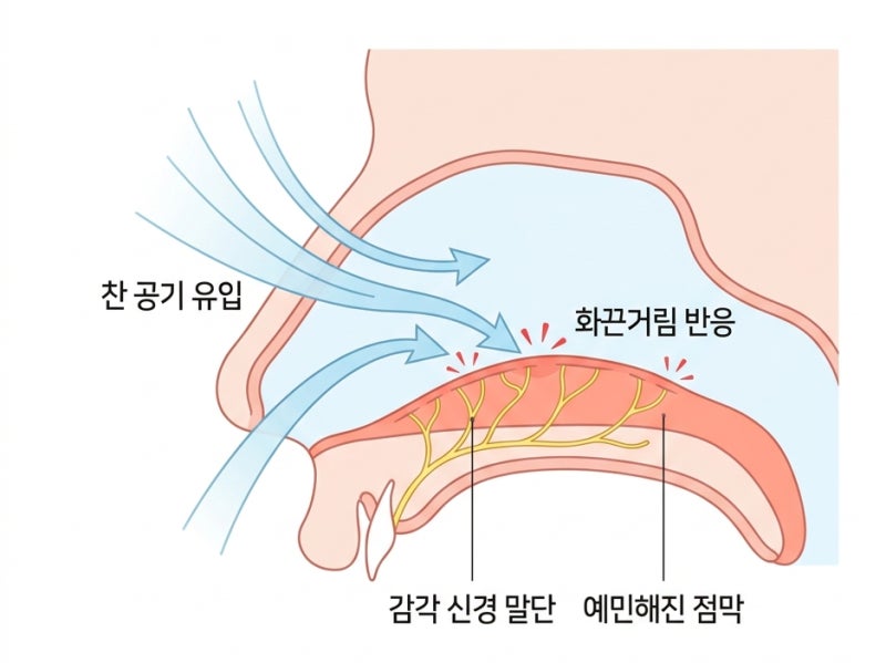 코수술 후 통증 부위별 원인과 절개부위 감염 신호 구분법 사진 2