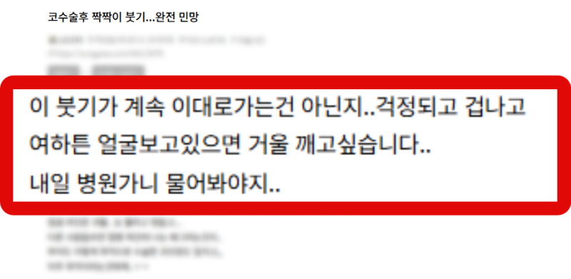 비개방코끝수술 붓기 걱정된다면 피해야 할 코끝 상태