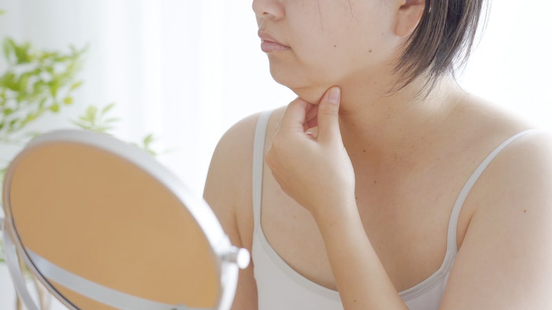 골든디아망 성형외과 지방분해주사 브이올렛 2cc 이벤트 가격 효과