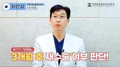 [제이준 유튜브] 하안검 무엇이든 물어보세요! 사진 5