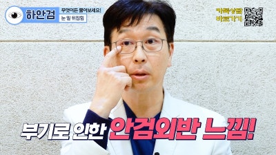 [제이준 유튜브] 하안검 무엇이든 물어보세요! 사진 4