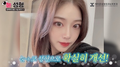 [제이준 유튜브] 눈 성형, 함께 하면 효과 좋은 수술 BEST 3! 사진 8