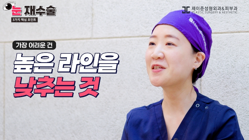 [제이준 유튜브] 눈 재수술을 막기위한 3가지 포인트! 사진 12