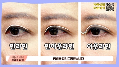 [제이준성형외과·피부과] 내 눈에 찰떡인 쌍꺼풀 라인! 미리 찾아보기👀 사진 4