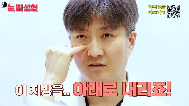 [제이준성형외과·피부과] 하안검? 눈밑지방재배치? 이것만 보고 결정하세요! 사진 2