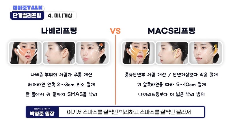 [제이준성형외과·피부과] 보톡스부터 안면거상까지, 내 처짐 수준에 맞는 리프팅 선택법 사진 20