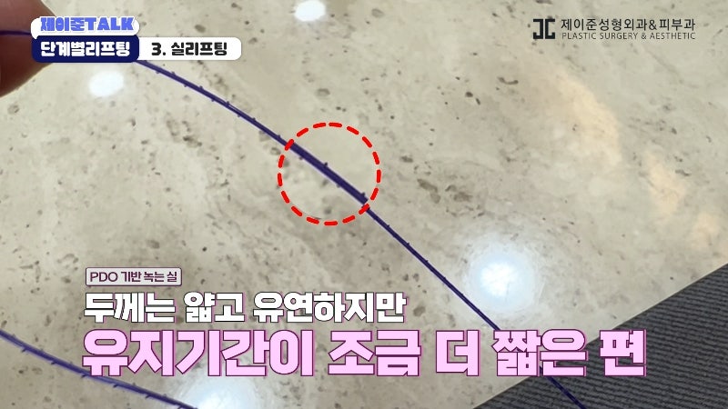 [제이준성형외과·피부과] 보톡스부터 안면거상까지, 내 처짐 수준에 맞는 리프팅 선택법 사진 17