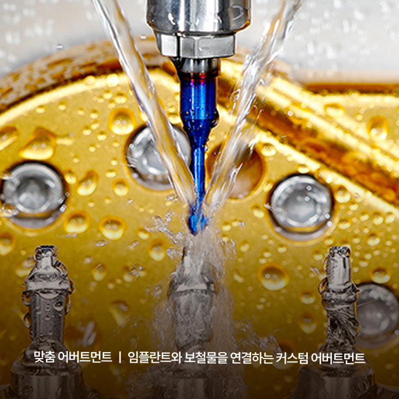 강남역임플란트치과추천 기준, 하루플란트치과 맞춤형 진료 시스템에서 확인하세요 사진 6