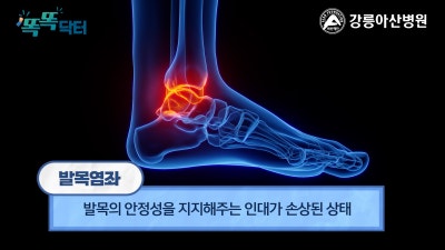[똑똑닥터] 러너들 주목! 발목 접질렸다면 꼭 보세요! | 발목염좌