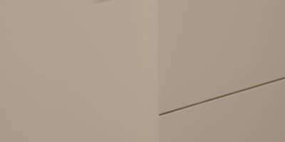 신사역입술필러, 녹이기 전 알아야 할 것들 사진 16