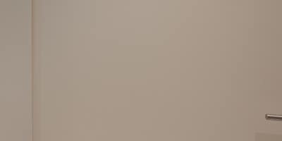신논현입술필러, 인중이 길어 보이는 게 고민이라면? 사진 28