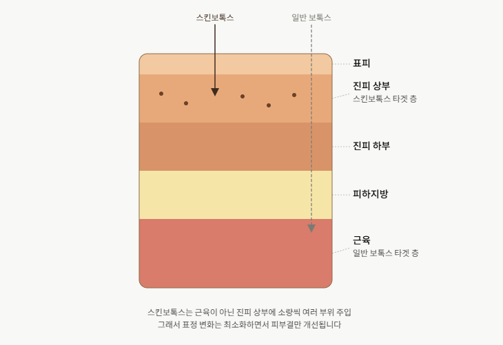 신사피부과 스킨보톡스, 제대로 알고 맞으면 결과가 다릅니다 사진 3
