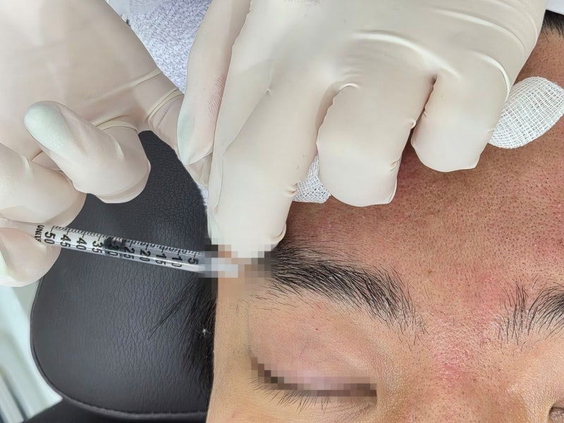 신사피부과 스킨보톡스, 제대로 알고 맞으면 결과가 다릅니다 사진 5