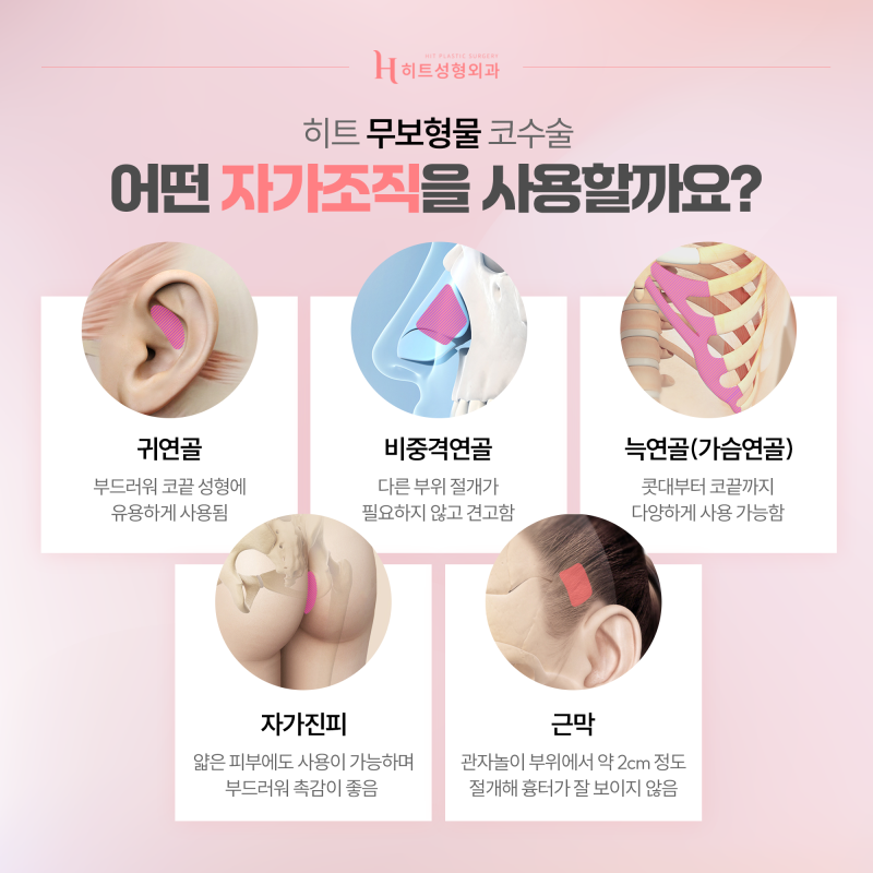 [히트성형외과] 자가 조직만으로 세련되게, 무보형물 코수술 사진 3